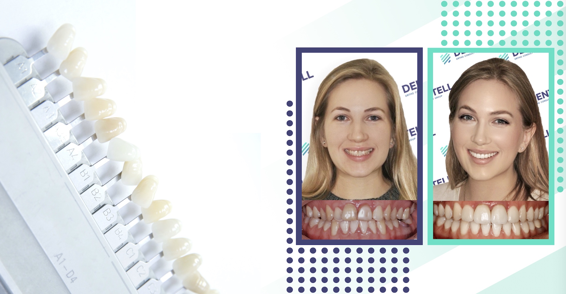 Dentell Group