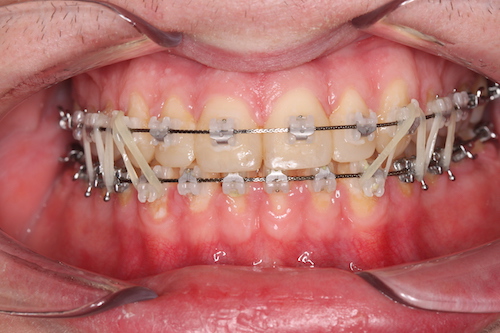 Dentell Group