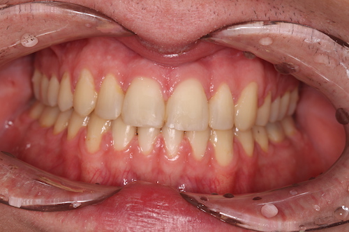 Dentell Group