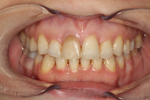 Dentell Group