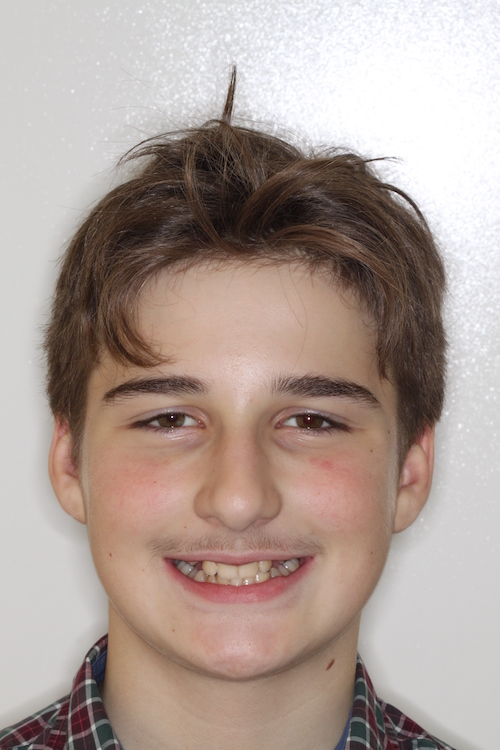 Dentell