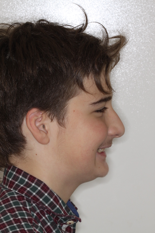 Dentell