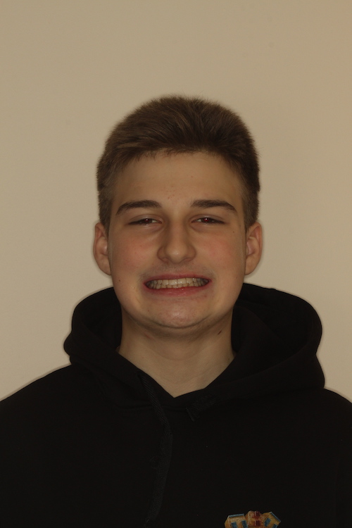 Dentell