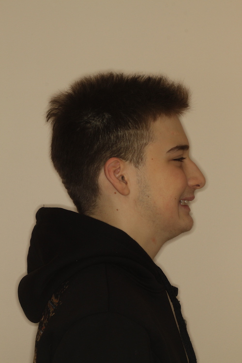 Dentell