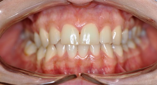 Dentell Group