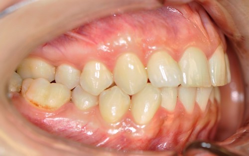 Dentell Group