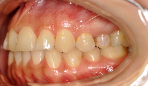 Dentell Group