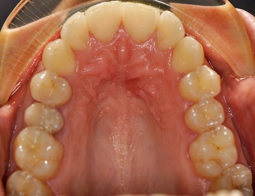 Dentell Group