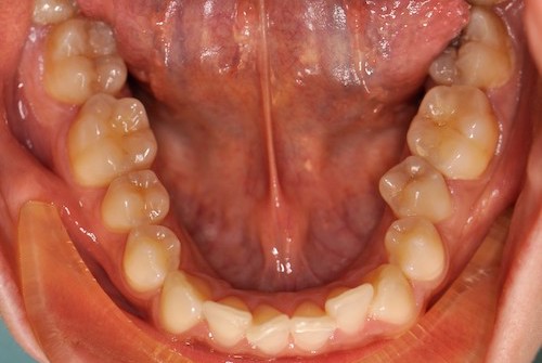 Dentell Group