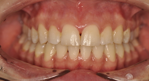 Dentell Group