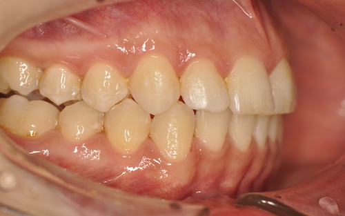 Dentell Group