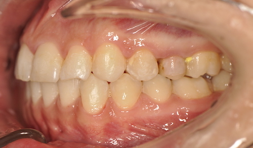 Dentell Group