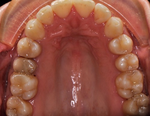 Dentell Group