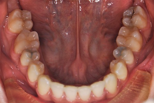 Dentell Group