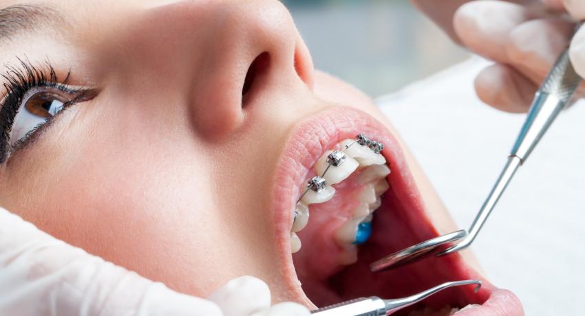 Dentell Group
