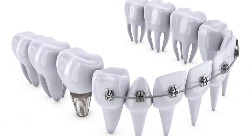 Dentell Group