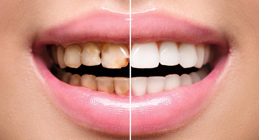 Dentell Group