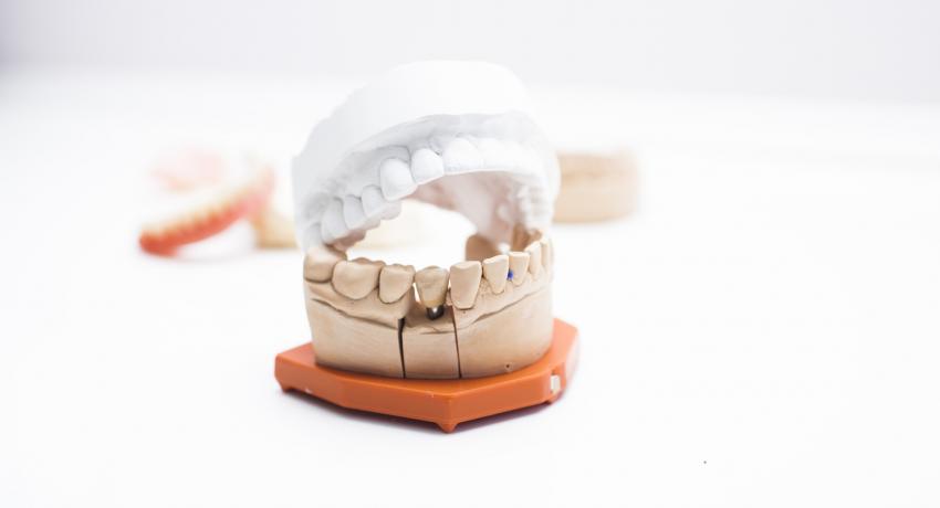 Dentell Group