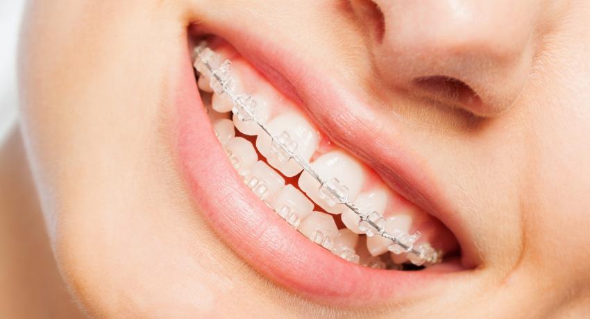 Dentell Group