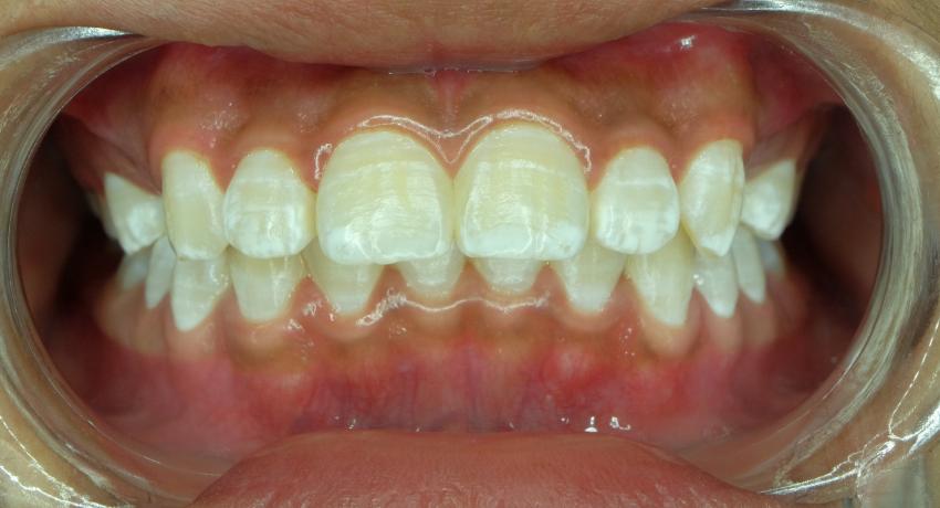 Dentell Group