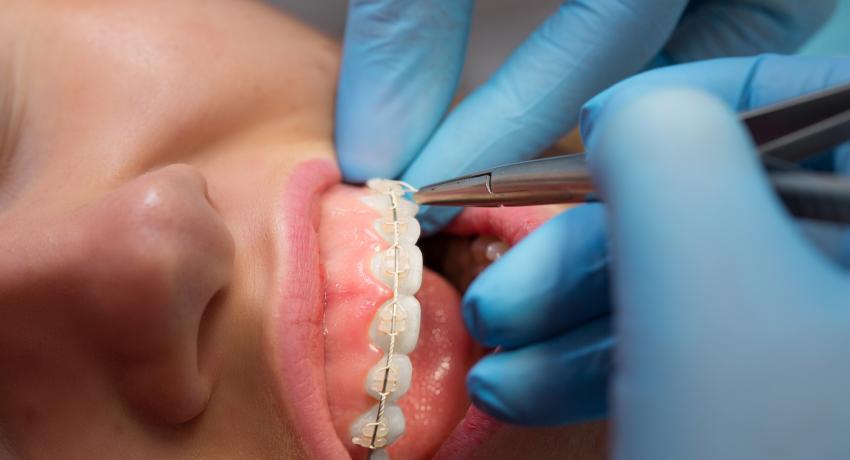 Dentell Group